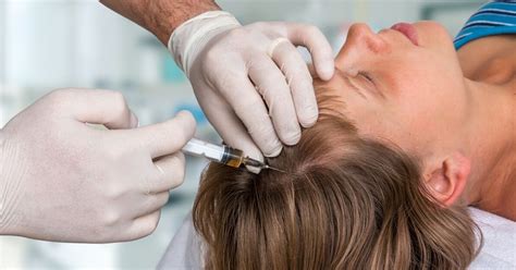 Haartransplantatie Complicaties En Risico’s