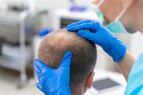 Haartransplantatie En Wonden: Wat U Moet Weten